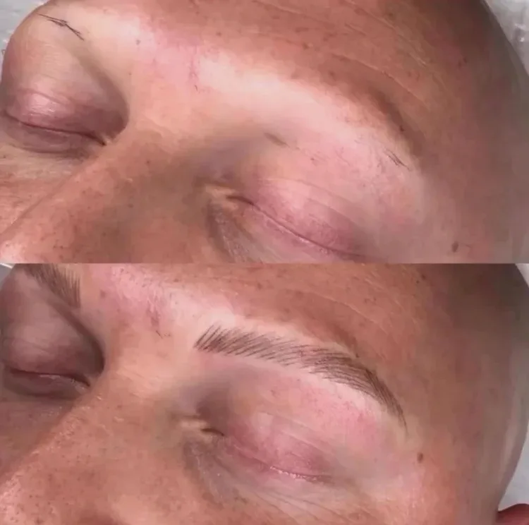 Eyebrow feathering, side profile — before and after